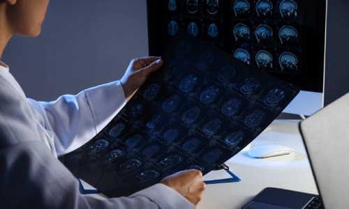 A doctor holding scans of an injured patient's brain up for viewing.